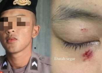 Oknum polisi Polda Jawa Barat diduga aniaya kekasih hingga babak belur, ini penyebabnya