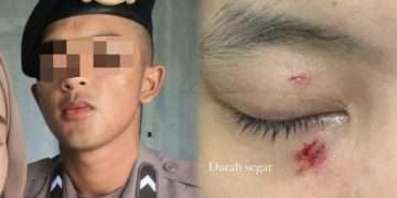 Oknum polisi Polda Jawa Barat diduga aniaya kekasih hingga babak belur, ini penyebabnya