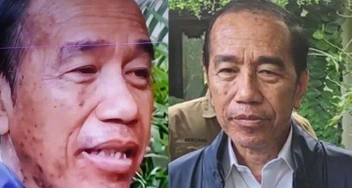 Heboh! Jokowi diduga idap penyakit langka Steven Johnson Syndrome, ajudan bilang begini