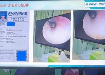 Heboh! Ketahuan Curang, Peserta UTBK Undip Tanam Alat di Telinga
