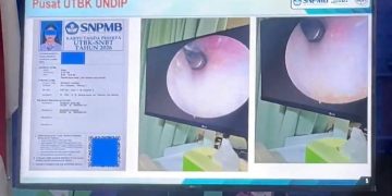 Heboh! Ketahuan Curang, Peserta UTBK Undip Tanam Alat di Telinga