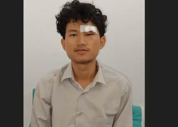 Mahasiswa UINSU Mengaku Dianiaya Rekan Kampus, Pelipis Mata Robek dan Kepala Benjol