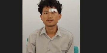 Mahasiswa UINSU Mengaku Dianiaya Rekan Kampus, Pelipis Mata Robek dan Kepala Benjol