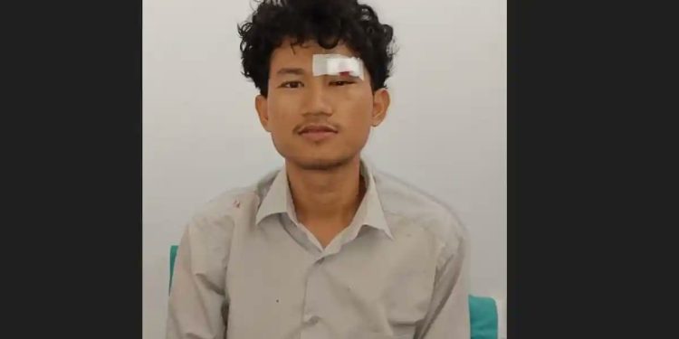 Mahasiswa UINSU Mengaku Dianiaya Rekan Kampus, Pelipis Mata Robek dan Kepala Benjol