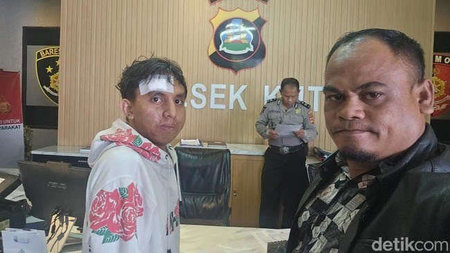 Pria Asal Sumba Jadi Korban Loker Palsu di Bali, Disekap dan Diperas hingga Rp100 Juta Oleh 2 Wanita