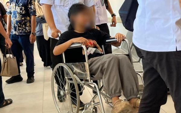 RSCM Bongkar Hasil Pemeriksaan Otak Siswi Karo Keracunan MBG yang Diduga Hilang Ingatan